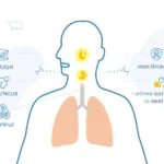 Medical illustration explaining yellow phlegm, cough, sinus drainage, and warning signs.